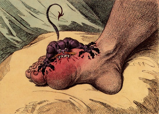 The_gout_james_gillray The Gout